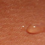 تاثیر امواج الکترومغناطیس بر پوست