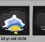 آسیب پذیری کودکان در برابر امواج الکترومغناطیسی