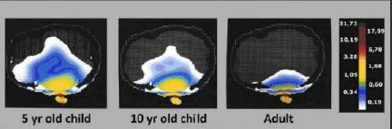 آسیب پذیری کودکان در برابر امواج الکترومغناطیسی