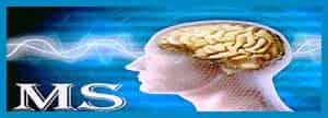 اثر امواج الکترومغناطیس و تشدید بیماری مالتیپل اسکلروزیس (MS)
